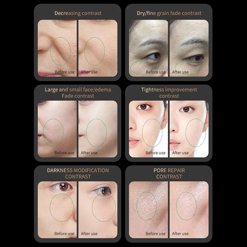 Red Light Collagen Regeneration Anti-Aging RF Beauty Device