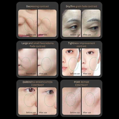 Red Light Collagen Regeneration Anti-Aging RF Beauty Device