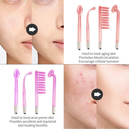 4-in-1 Portable High Frequency Facial Beauty Machine