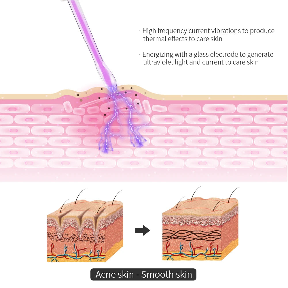 4-in-1 Portable High Frequency Facial Beauty Machine