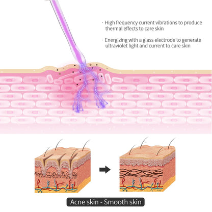 4-in-1 Portable High Frequency Facial Beauty Machine