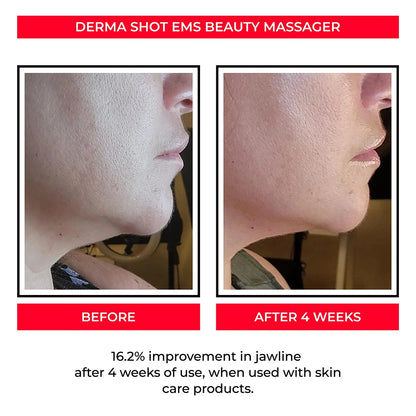 3D Sculptor Beauty Roller – V-Line Facial & Muscle Ball Massager